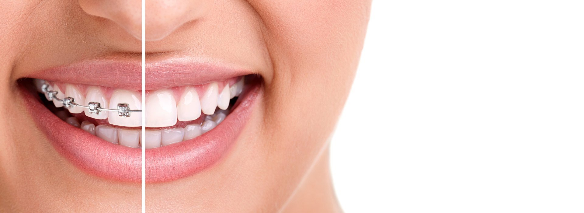 Orthodontist Melbourne