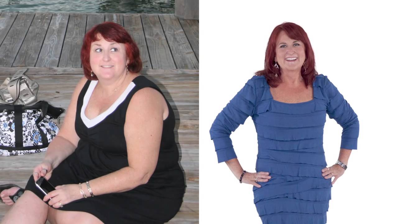 weight loss surgery melbourne